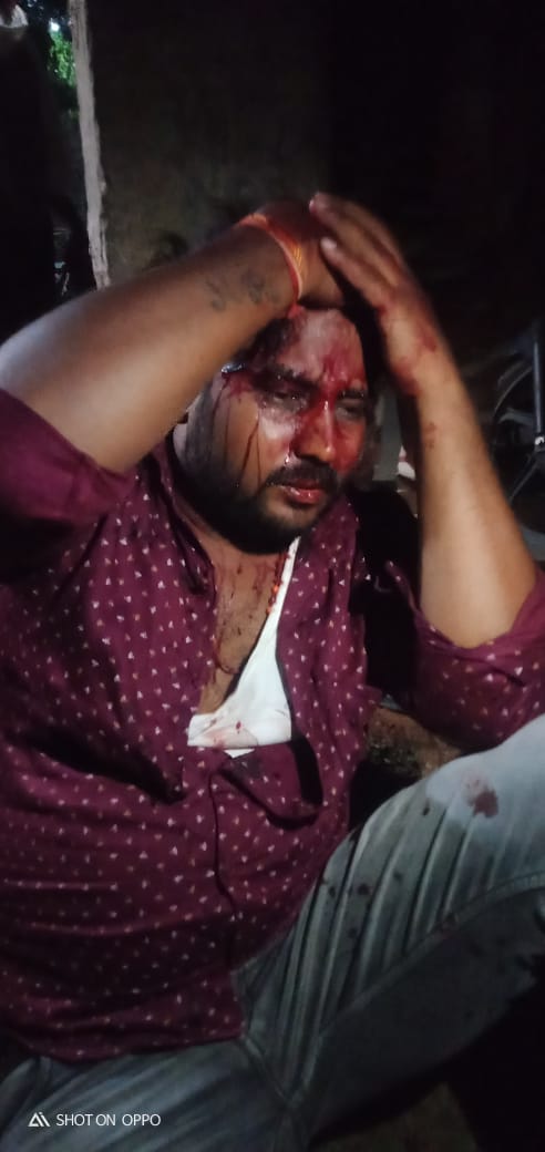 देवघर :  पुनासी पंचायत के मुखिया प्रत्याशी पर जानलेवा हमला