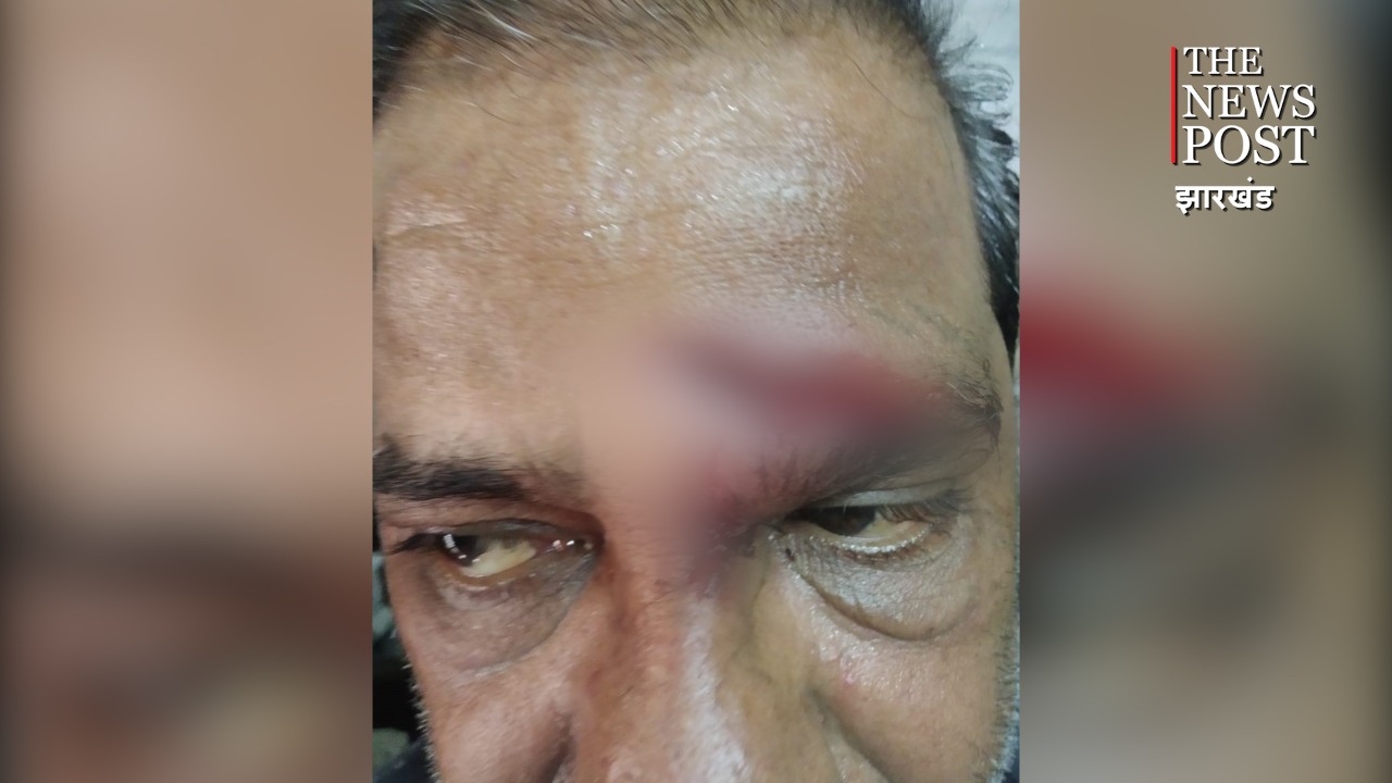 BREAKING: कतरास के  रानी बाजार में डाका ,घर मालिक को घायल कर लूटपाट 