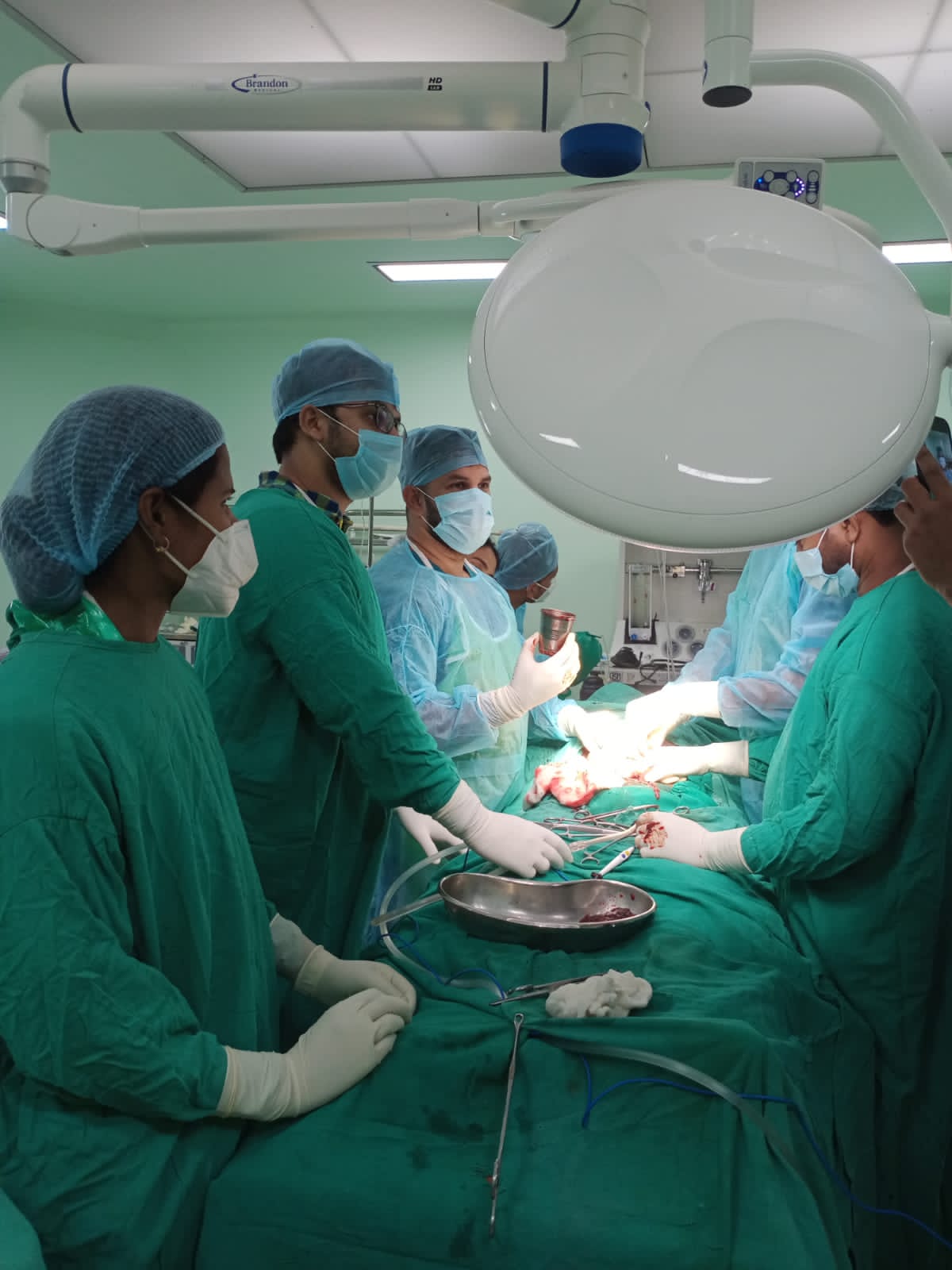 22 वर्ष के युवक के पेट में फंसा था स्टील का ग्लास, PMCH के डॉक्टरों ने सर्जरी कर निकाला बाहर