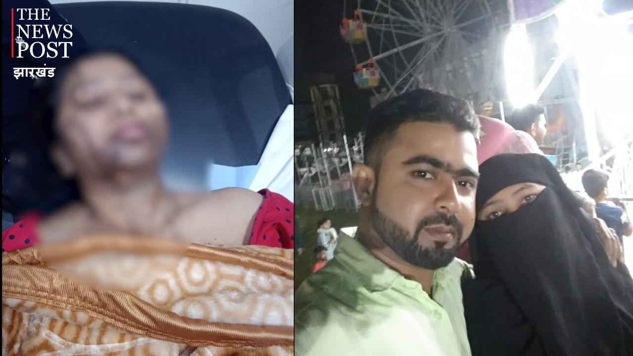 पत्नी पर एसिड अटैक, गंभीर हालत में रिम्स में भर्ती, जानिए मामला