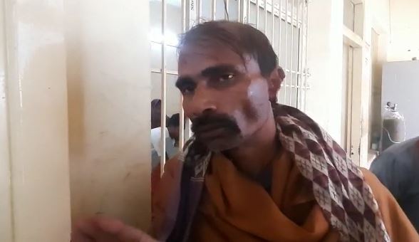 नाक की लड़ाई में कान कटा बैठे चाचा, कटा कान लेकर भतीजा हुआ फरार, जानिए क्या है मामला 