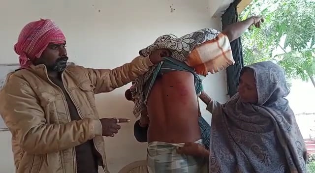 शर्मनाक ! झारखंड में दलित युवक को जबरन प्रतिबंधित मांस खिलाने का आरोप, मना करने पर आरोपियों ने जमकर की पिटाई, टूटा हाथ