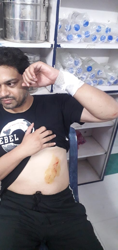 बॉडीगार्ड के सामने ही विधायक पर कर दी ईंट पत्थर की बौछार, हमला के बाद हमलावर यूं हुए नौ-दो-ग्यारह