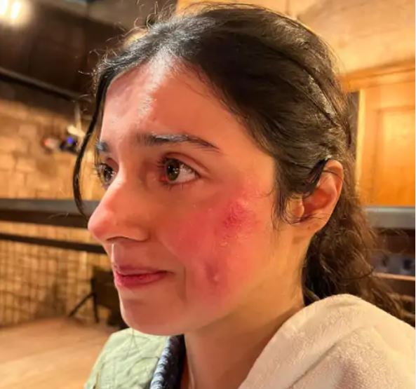 दिव्या खोसला शूटिंग के दौरान हुई घायल, पोस्ट शेयर कर फैंस को दी जानकारी