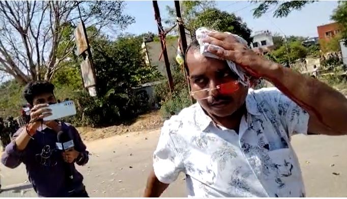 पुलिस प्रर्दशनकारियों की भिड़त में एक पत्रकार घायल, उग्र हुए प्रर्दशनकारी