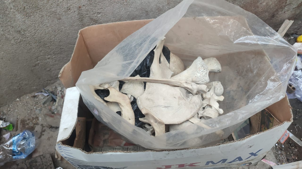 पटना : नगर निगम के डस्टबिन में मिला मानव खोपड़ी और हड्डी, जांच में जुटी एफएसएल की टीम