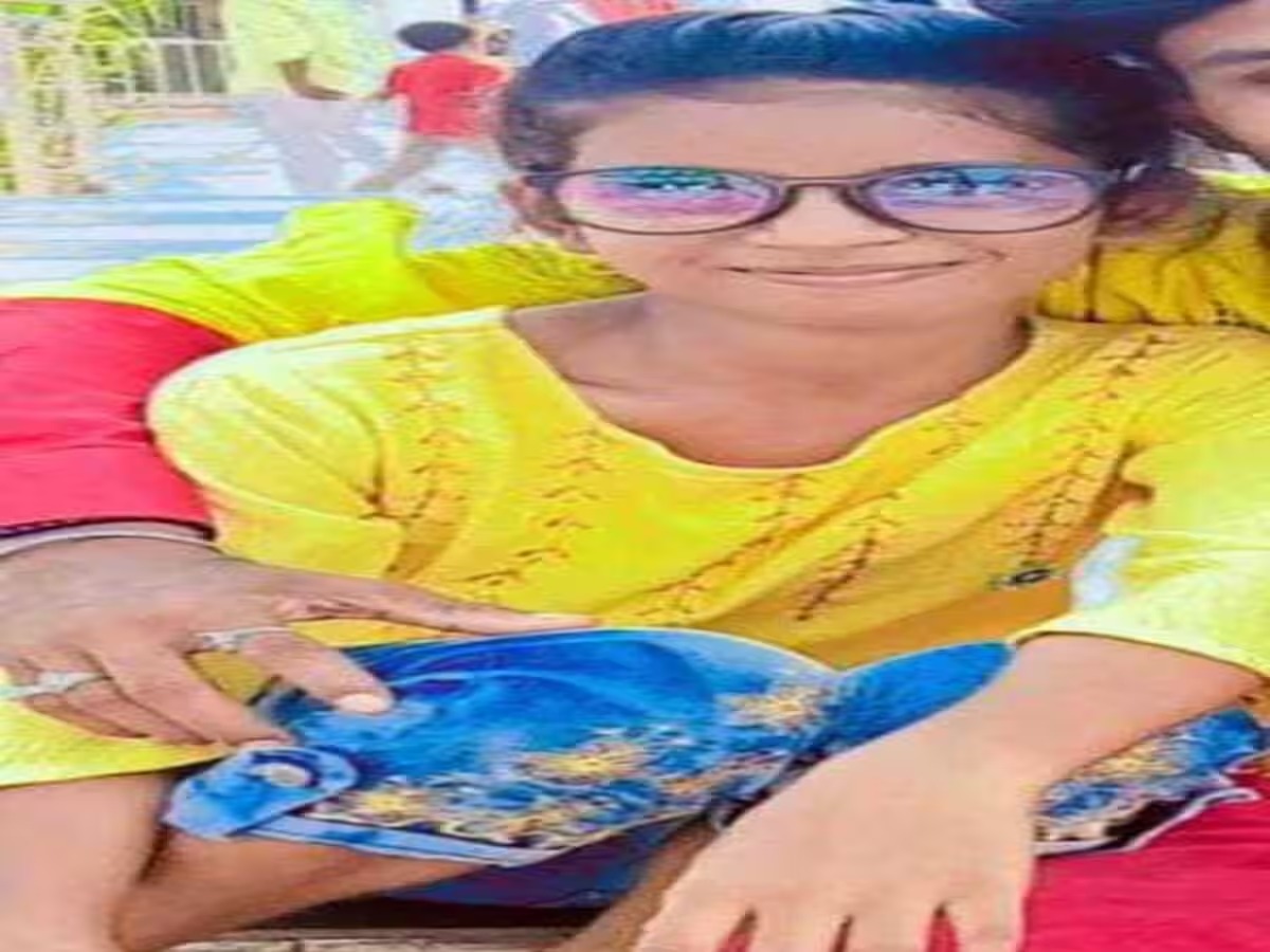 झरिया की आग हुई भयावह -गर्म ओ बी से झुलसी बच्ची हार गई जीवन की लड़ाई ,बुआ की हालत गंभीर  