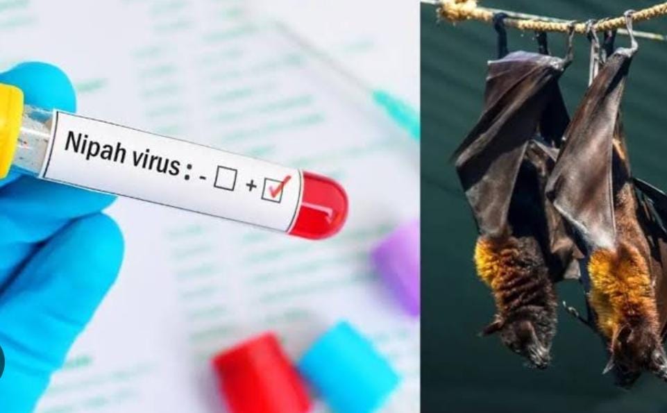 Nipah Virus:जमशेदपुर में डेंगू के बाद निपाह वायरस का बढ़ा खतरा, जानें स्वास्थ्य विभाग ने सभी अस्पतालों को क्या दिया निर्देश
