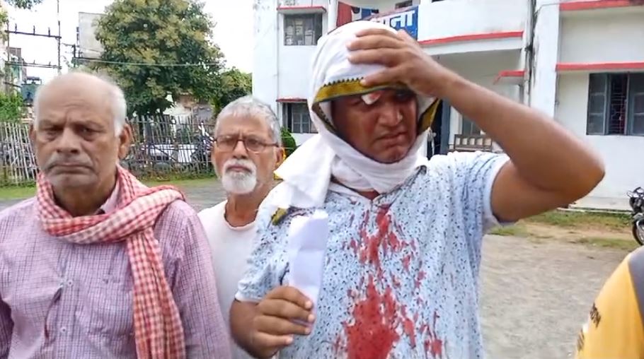 जमीन विवाद में दो पक्षों में जमकर मारपीट, एक व्यक्ति गंभीर रुप से घायल