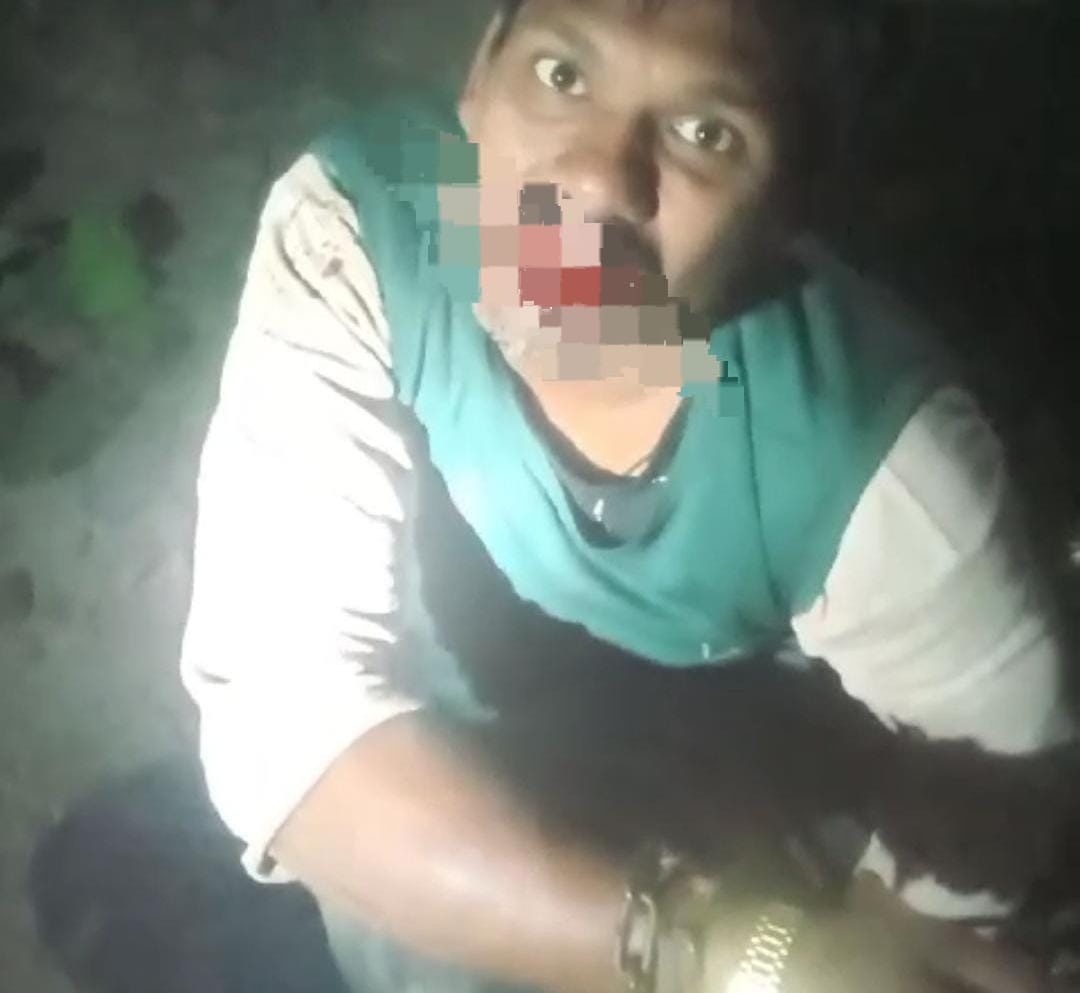 बगहा: चोर के आरोपी की जंजीर में बांधकर पिटाई, रहम की मांगता रहा भीख, लेकिन लोगों ने एक ना सुनी