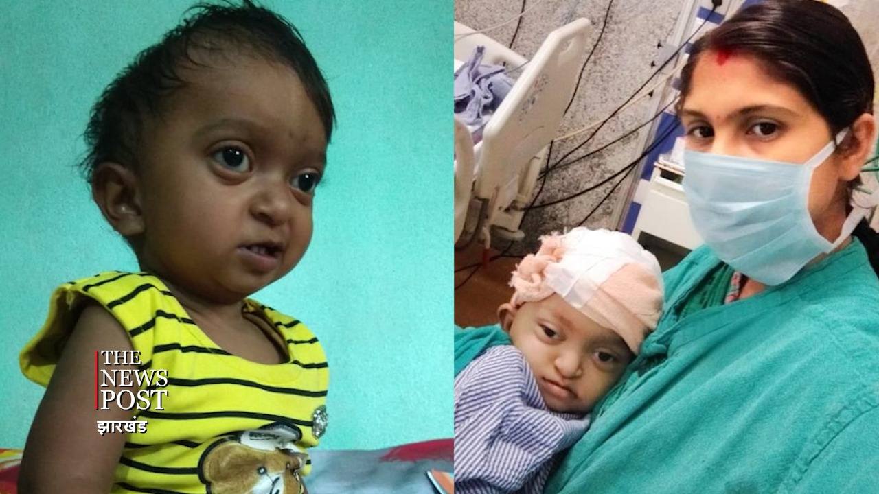 अनोखी बीमारी से परेशान थी नन्हीं परी, फिर इडली बेचने वाले पिता ने ऐसे कराया खर्चीला इलाज