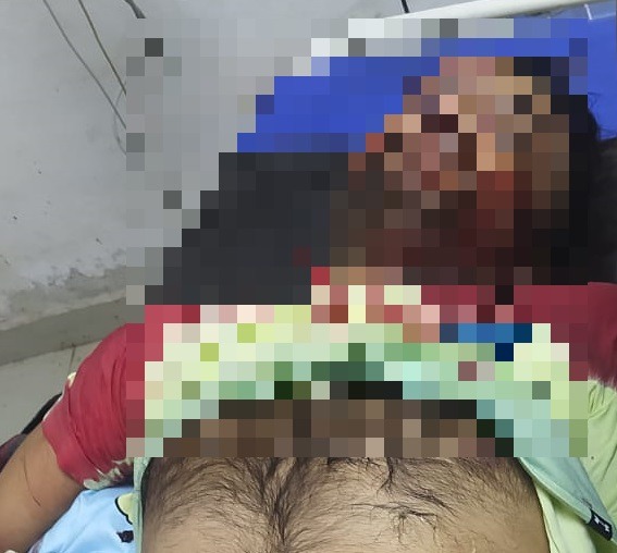 BIG BREAKING :-धनबाद जेल में अमन सिंह की हत्या ! सिर में मारी गई गोली , क्या जेल के अंदर गैंगवार में गई जान ?