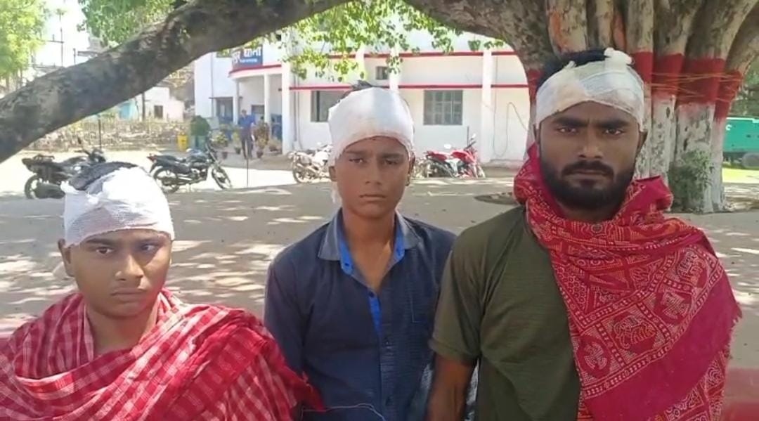 देवघर: दबंगों ने एक ही परिवार के 3 भाइयों पर किया जानलेवा हमला, सभी घायल, पढ़ें रंजिश की वजह  