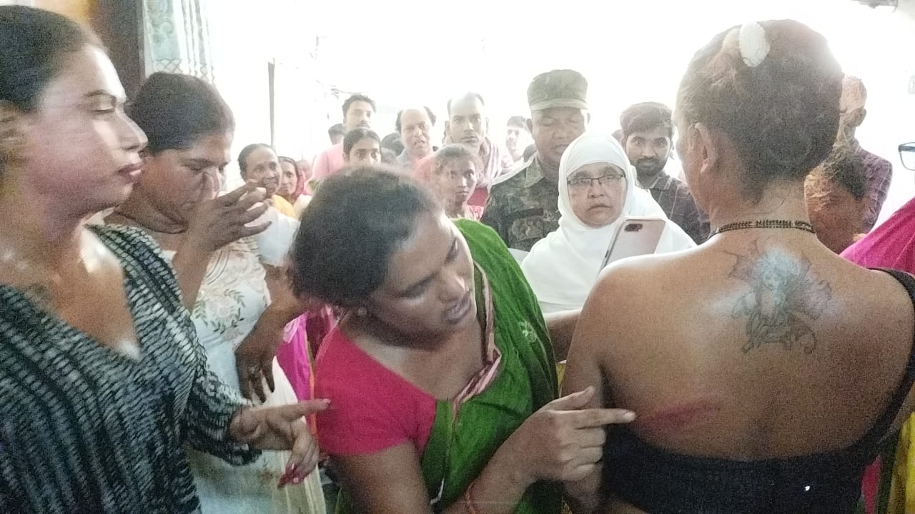 दुमका: किन्नरों की टोली गयी थी बधाई मांगने, मिली पिटाई, जानिए पूरा मामला