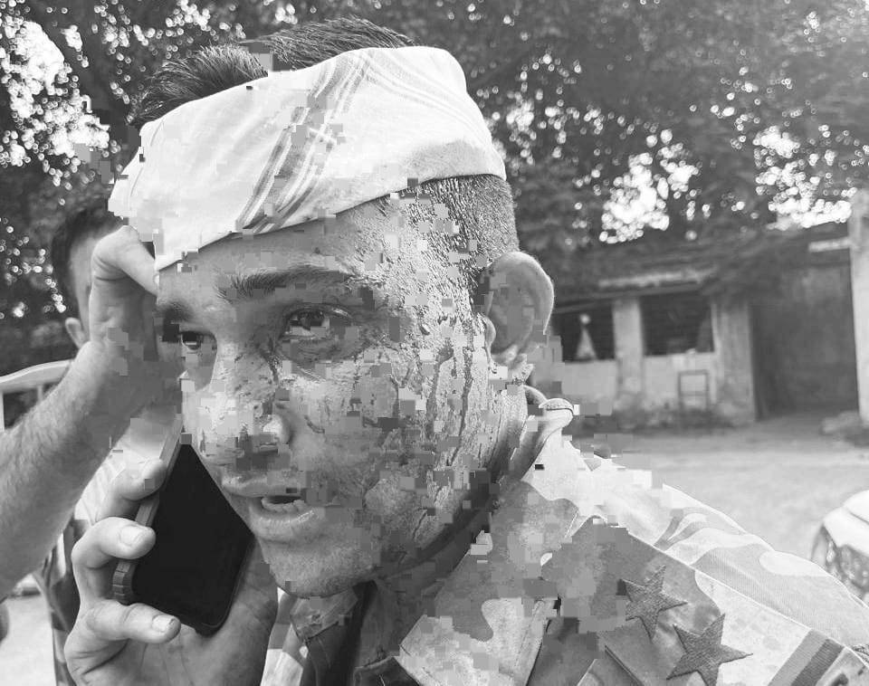 देवघर में दिखी कोयला चोरों की दबंगई! चोरों ने CISF इंस्पेक्टर को किया लहूलुहान, पढ़ें पूरा  मामला  