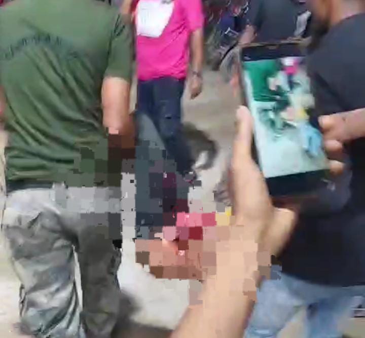 बिहार का जीआरपी जवान बना हैवान! मामूली विवाद में व्यक्ति की कर दी पिटाई, बाहर आ गई आंत, पढ़ें फिर क्या हुआ