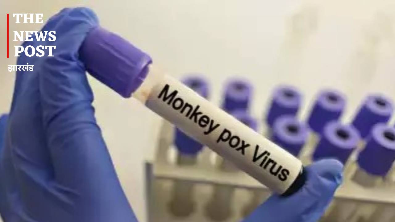 मंकीपॉक्स को लेकर भारत अलर्ट, केंद्र का एयरपोर्ट-बॉर्डर पर एहतियात बरतने का निर्देश, राज्य सरकारों के लिए भी गाइडलाइन जारी