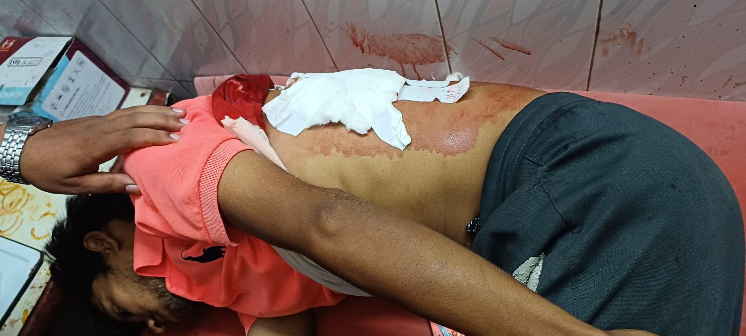 BIG BREAKING : धनबाद के चासनाला में रिकवरी एजेंट को गोली मार पांच लाख की हुई लूट 