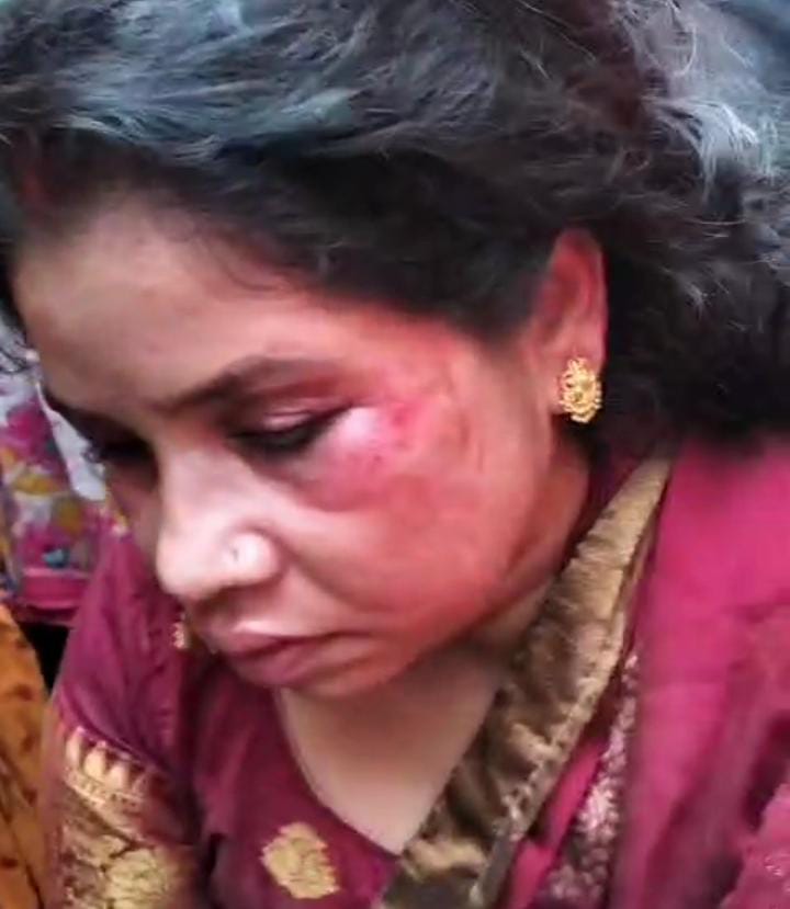 Bihar News: दरिंदगी की हद! जदयू की महिला जिलाध्यक्ष के साथ हुई बर्बरता, चप्पल की माला पहनाकर सड़क पर घुमाया, देखें वीडियो