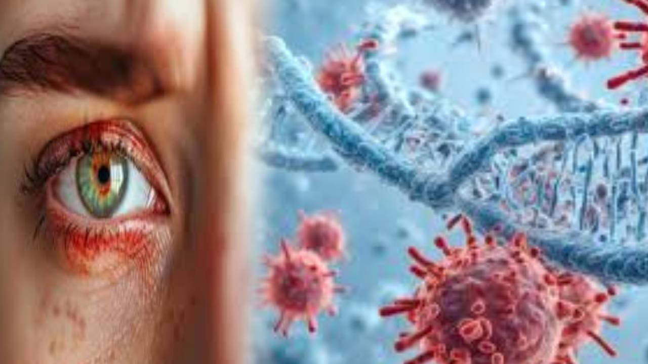 Bleeding Eye Virus: दुनिया में तेजी से फैल रहा आंखों का नया खतरनाक वायरस, 15 लोगों की मौत, 17 देशों में अलर्ट