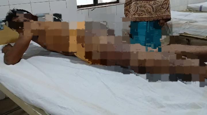 वर्दी का बेरहम चेहरा! हाजीपुर पुलिस ने युवक को इतना पीटा कि पहुंच गया अस्पताल, मामले पर शुरु हुई राजनीति