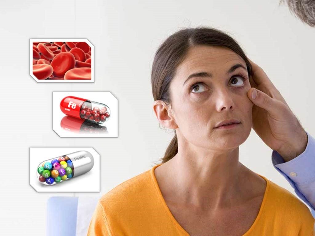 National Anaemia Day: पुरुषों की तुलना में ज्यादातर महिलाओं में क्यों होती है खून की कमी, जानिए इससे निपटने के  तरीके