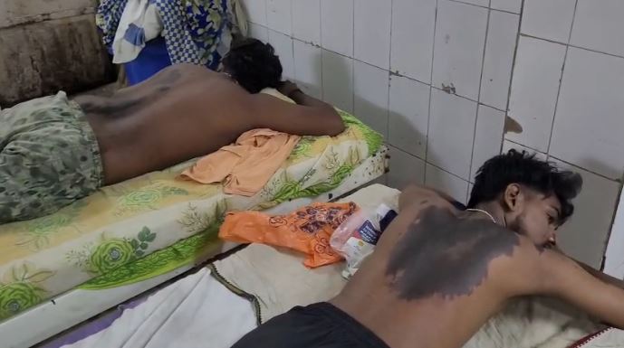 बड़ी खबर: जाति पर उठाया सवाल तो बीच सड़क पर दौड़ा-दौड़ा कर तेजाब से नहलाया, दहल उठा इलाका