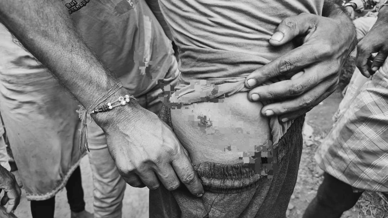 BREAKING:आजसू नेता अज़हर इस्लाम के पत्थर खदान में तोड़फोड़, हेवी ब्लास्टिंग के बाद लोगों की घरों की उड़े चिथड़े 