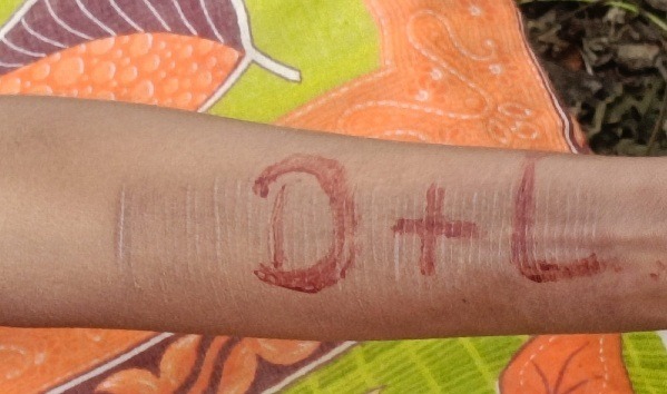 जमशेदपुर के धालभूमगढ़ में नाबालिग की मौत बनी पहेली ! खेत के पास शव बरामद, हाथ पर लिखा D+L बना सुराग