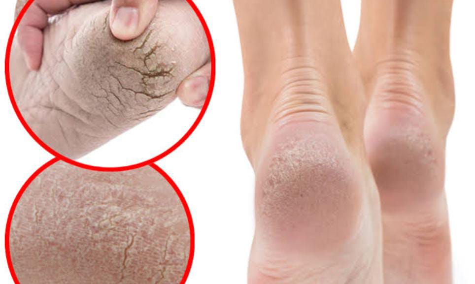 প্রাণিসম্পদমন্ত্রীর