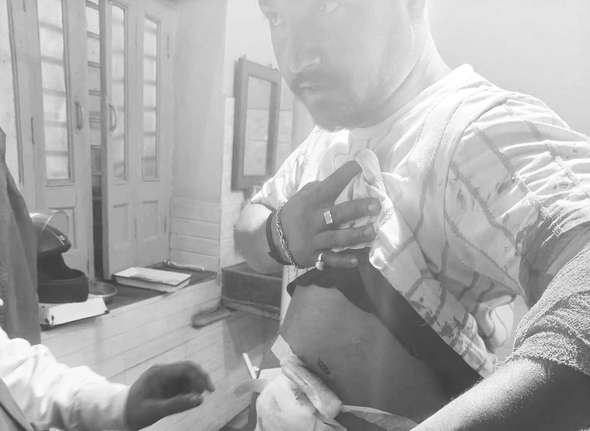 झरिया के फतेहपुर में युवक पर भुजाली से हमला, हालत गंभीर