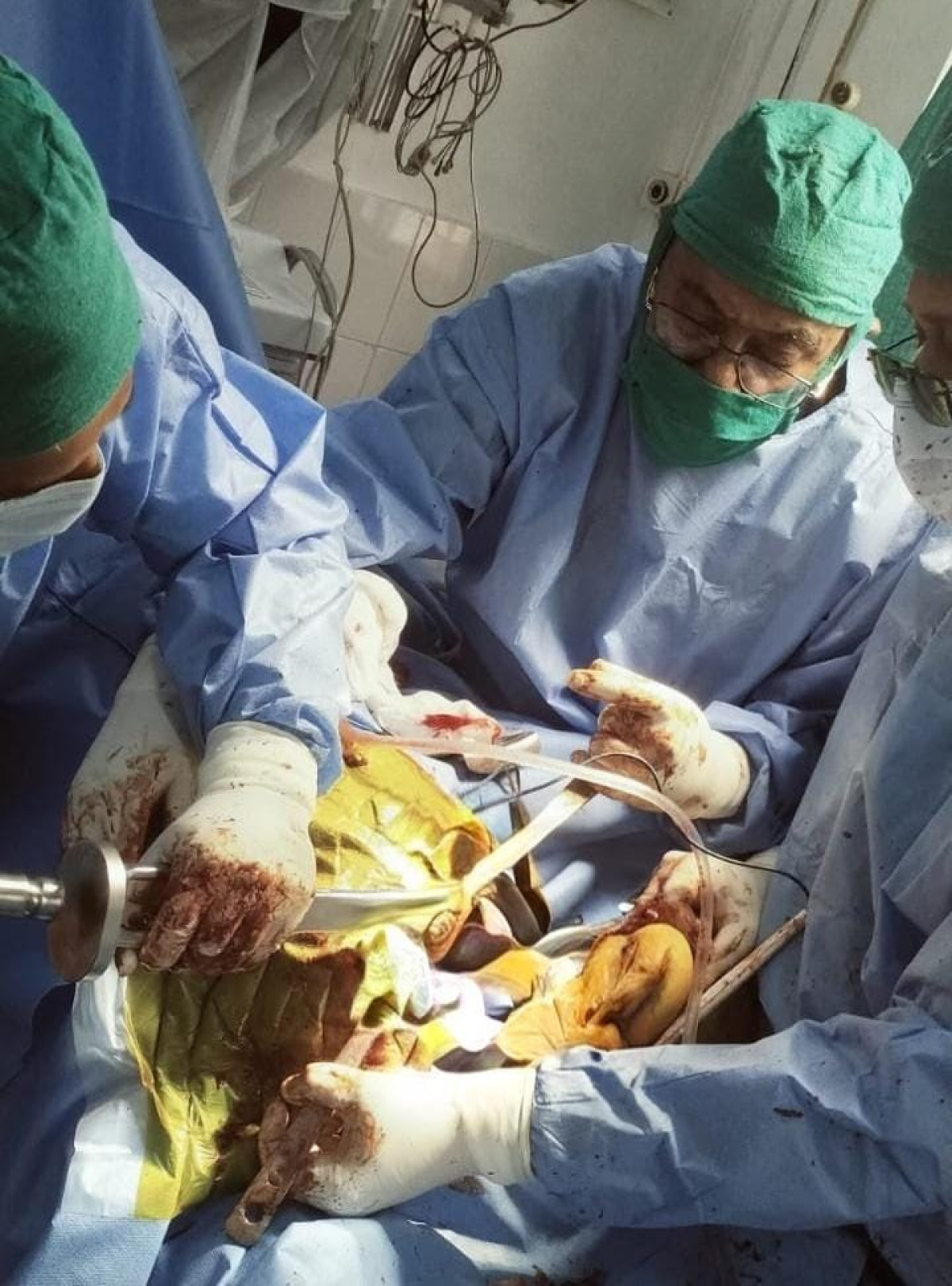 धनबाद सदर अस्पताल के नाम जुड़ गई एक बहुत बड़ी उपलब्धि ,बढ़ रहा मरीजों का भरोसा