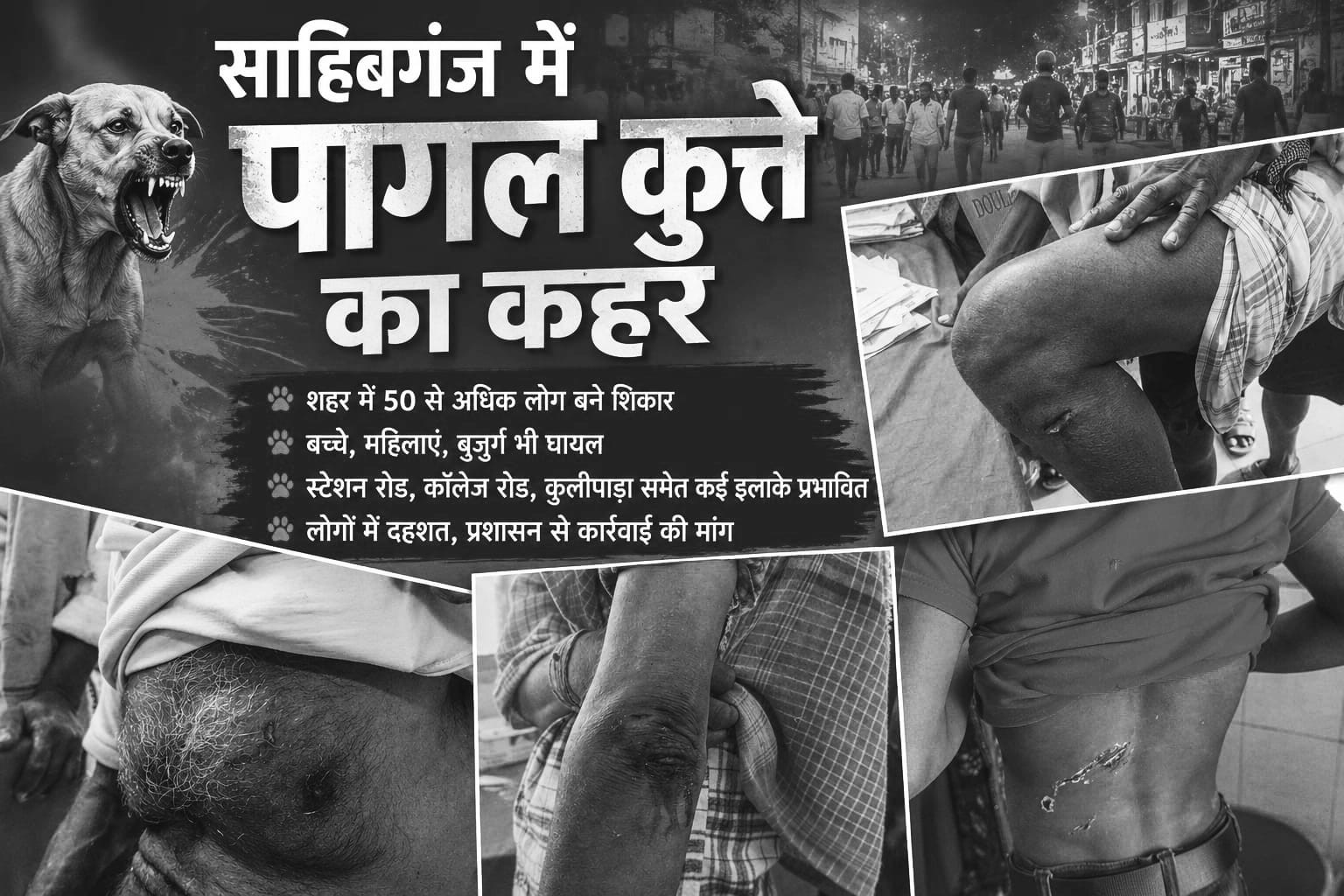टीवी पर लाइव दिखेगा सलीमा का जलवा, सलीमा  के परिवार वाले सरकारी टीवी पर देखेंगे अपनी बेटी का खेल..!