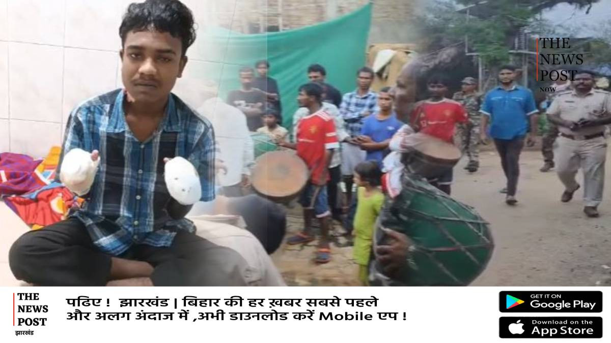 पहले चोरी का लगाया आरोप फिर सच्चाई की परीक्षा के नाम पर जला दिया हाथ,काटनी पड़ गई 10 उंगली