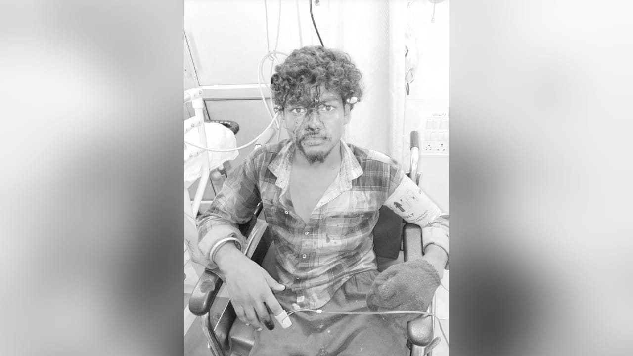 आदित्यपुर की फैक्ट्री में विस्फोट से 5 मजदूर घायल, 3 की हालत गंभीर