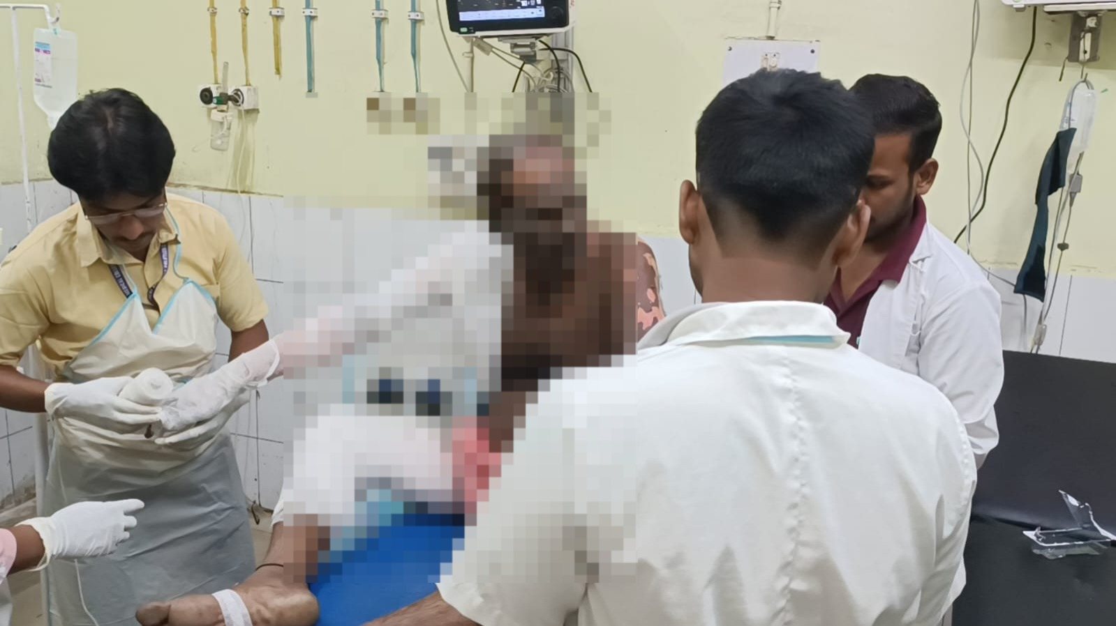धनबाद:पाथरडीह कोल वाशरी में बड़ा हादसा, वेल्डिंग मशीन फटने से 3 मजदूर घायल