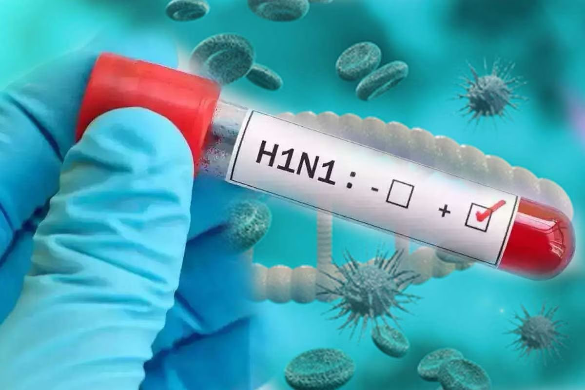 स्वाइन फ्लू का बढ़ता खतरा! H1N1 से बचने के लिए अपनाएं ये जरूरी सावधानियां