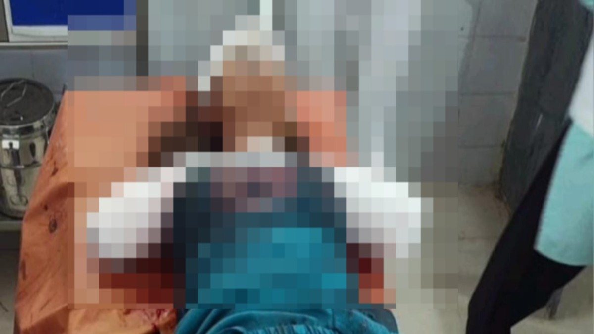 गढ़वा: रेलवे ट्रैक पर Reel बनाना पड़ा भारी, 19 साल की युवती ट्रेन की चपेट में आई, दोनों हाथ कटे