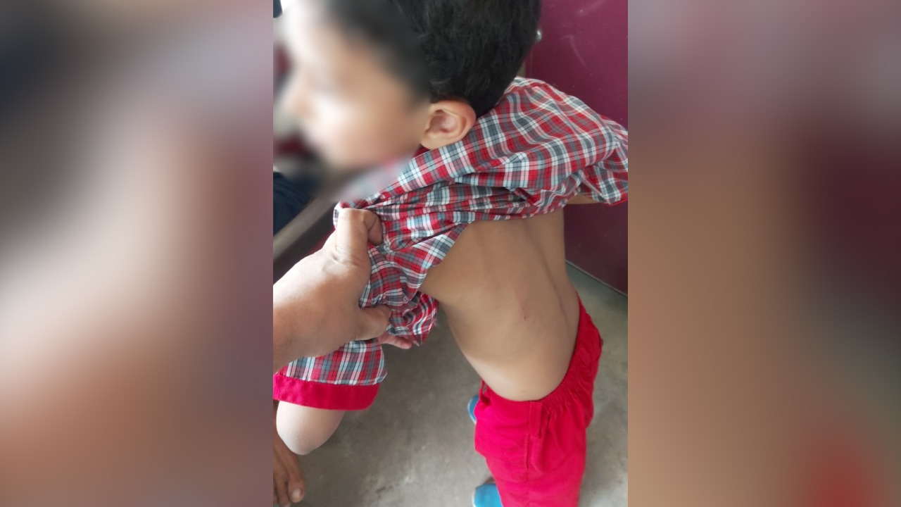 अरोड़ा स्कूल के टीचर ने मासूम छात्र की बेरहमी से की पिटाई, परिजनों ने दर्ज की शिकायत