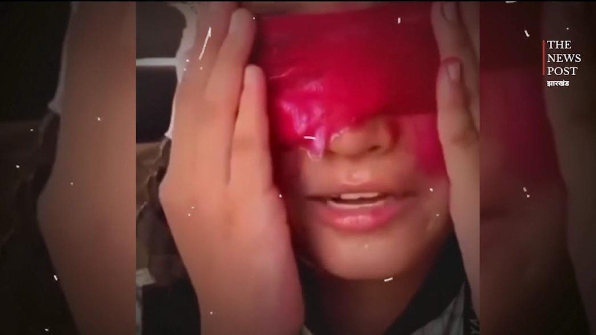 डॉक्टर ने निकाल ली बच्चे की आंख...! मोबाइल छुड़ाने के लिए किया ऐसा हाल, वीडियो देख दहल जाएगा कलेजा