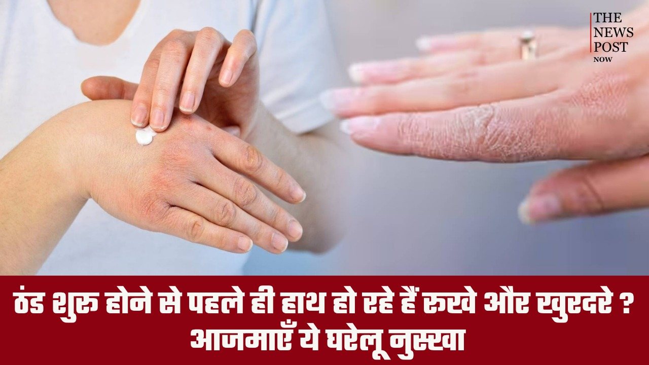 ठंड शुरू होने से पहले ही हाथ हो रहे हैं रूखे और खुरदरे? आजमाएँ ये घरेलू नुस्खा